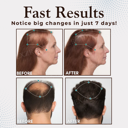AEXZR® Hair Regrowth Capsules