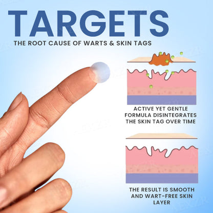Dobshow™ Moles & Warts Removing Skin Tag Patch