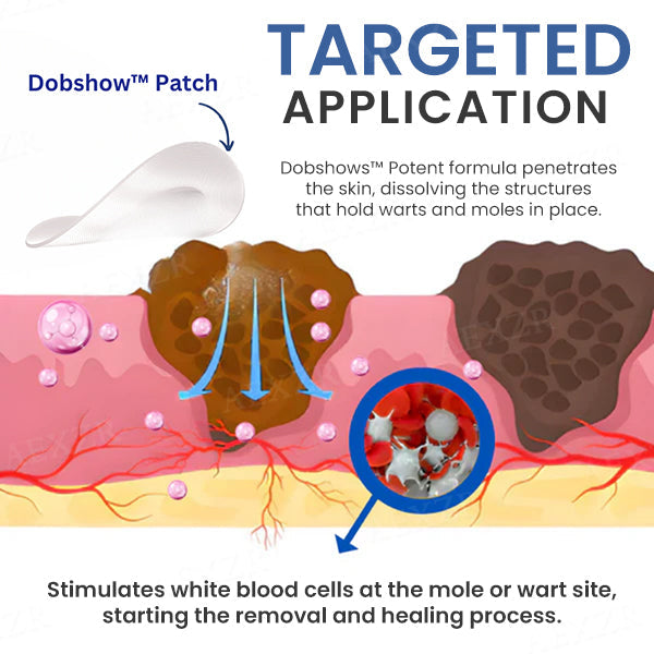 Dobshow™ Moles & Warts Removing Skin Tag Patch