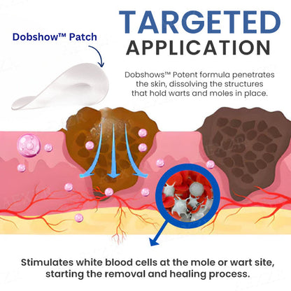 Dobshow™ Moles & Warts Removing Skin Tag Patch