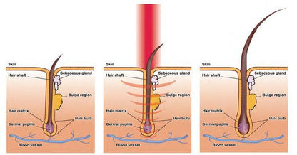 AEXZR® Home Medical Hair Growth Device