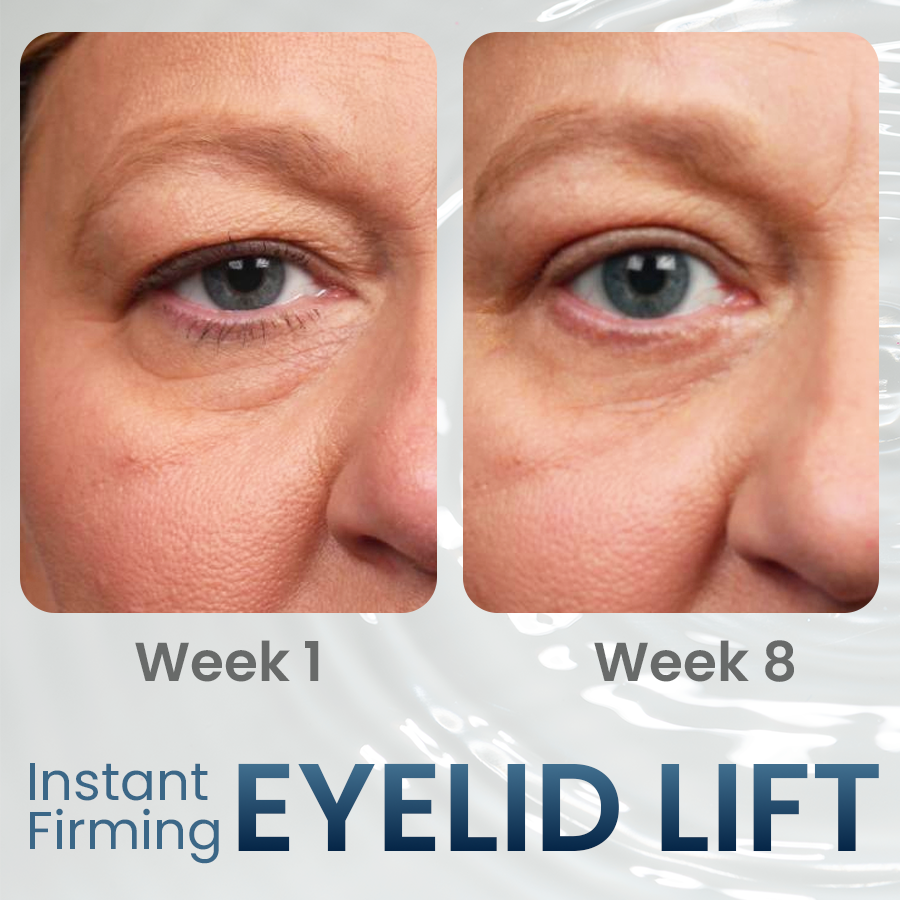 Dobshow™ Lapagyl Eye Firming Gel