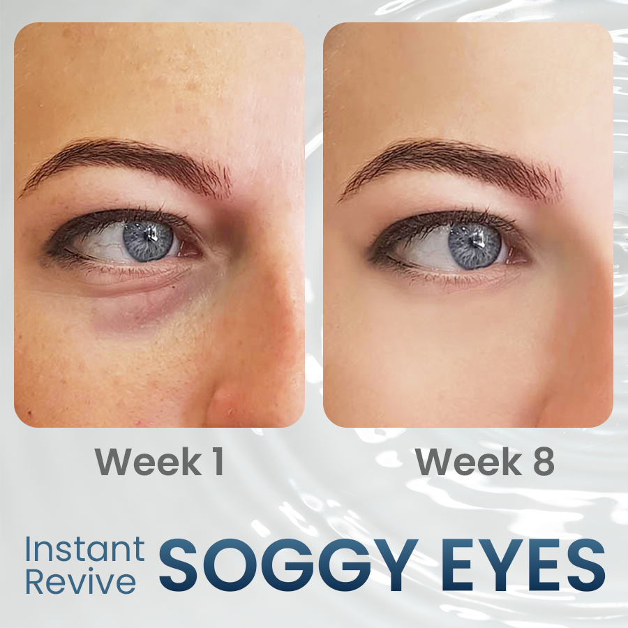 Dobshow™ Lapagyl Eye Firming Gel
